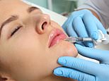 Terrifying life-long risks of lip filler – chemicals may seep into the bloodstream fuelling CANCER, claim experts