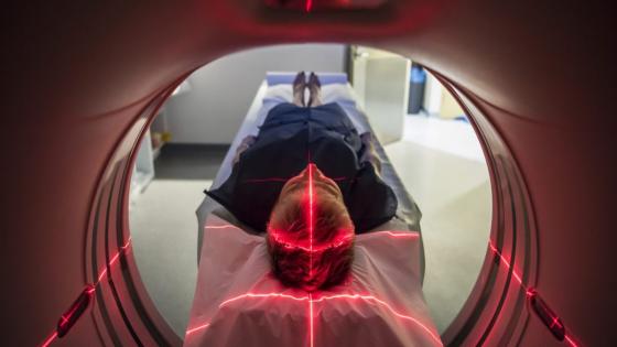 Are CT scans safe? Research says they could drive up cancer cases
