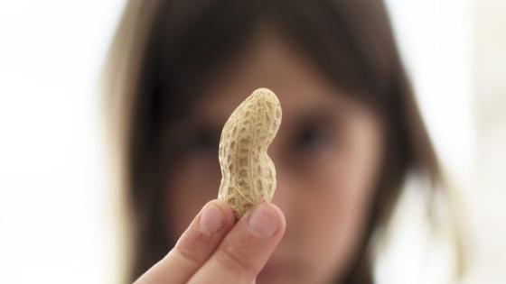 Food allergies are soaring, and hundreds of moms are fed up with ‘dangerous’ jokes about them