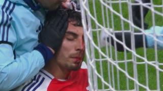 Kai Havertz left with blood pouring from his head after Arsenal star’s sickening clash of heads