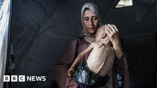 Mother of starving baby speaks to BBC