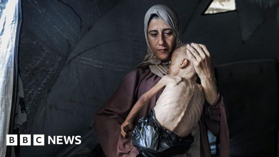Mother of starving baby speaks to BBC