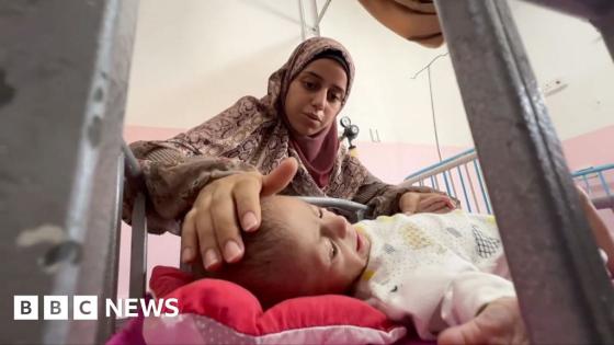 Gaza parents desperate as children face starvation under Israeli blockade
