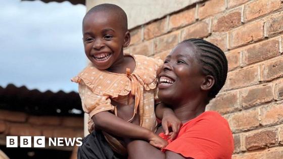 'I adore her now': Mother learns to live with child's autism in a country with little help