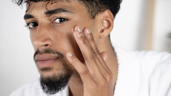 5 common summer skin issues and how to treat them, according to a doctor