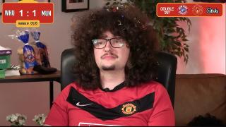 ‘We don’t see it as cool’ – Man Utd star admits hairy fan is piling on the pressure in dressing room